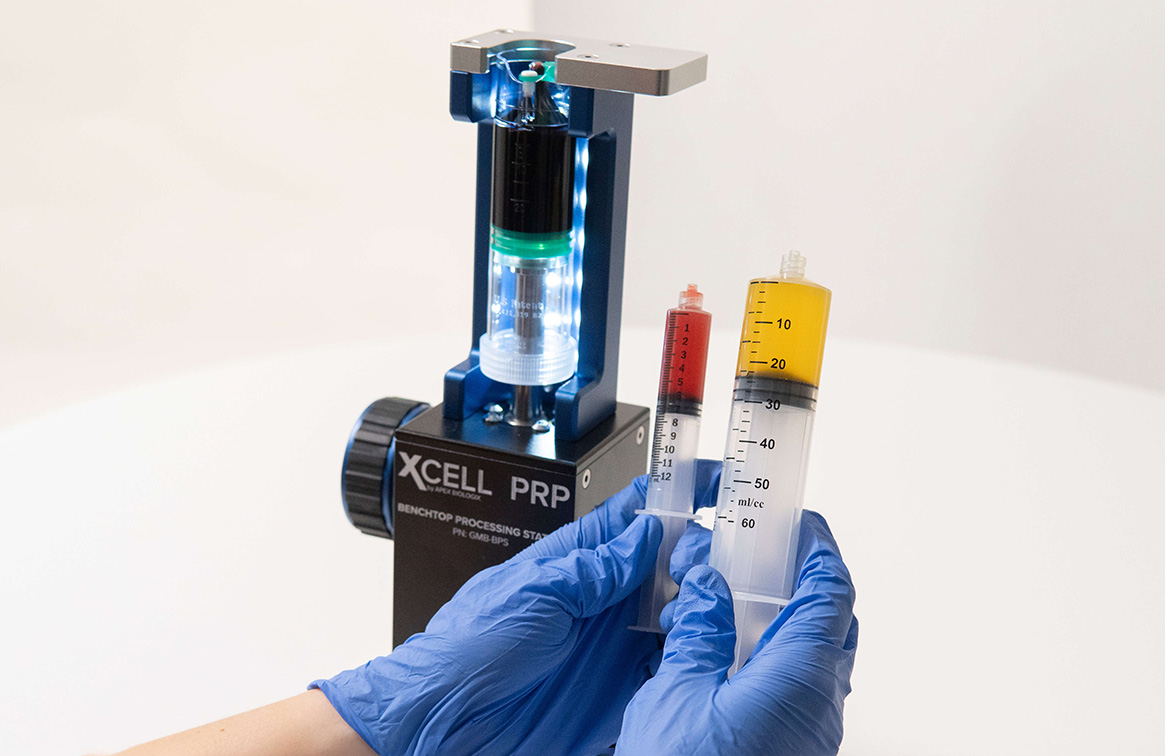 PRP in Carlsbad, CA | North County Primary Care